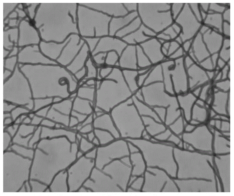 Streptomyces Iividans and application thereof