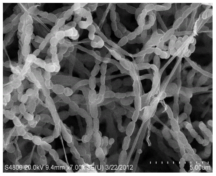 Streptomyces Iividans and application thereof