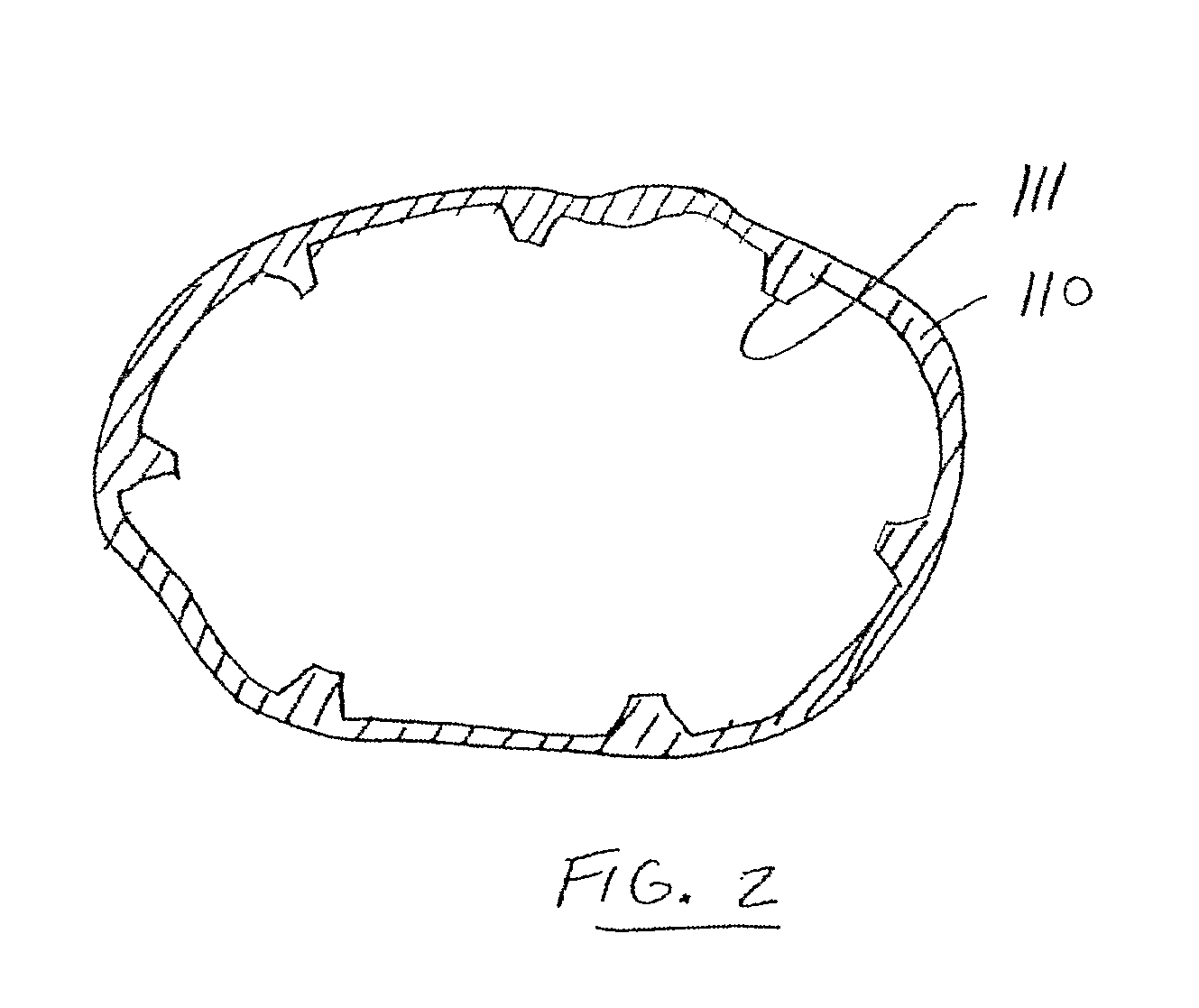 Gastric Bypass Devices and Methods