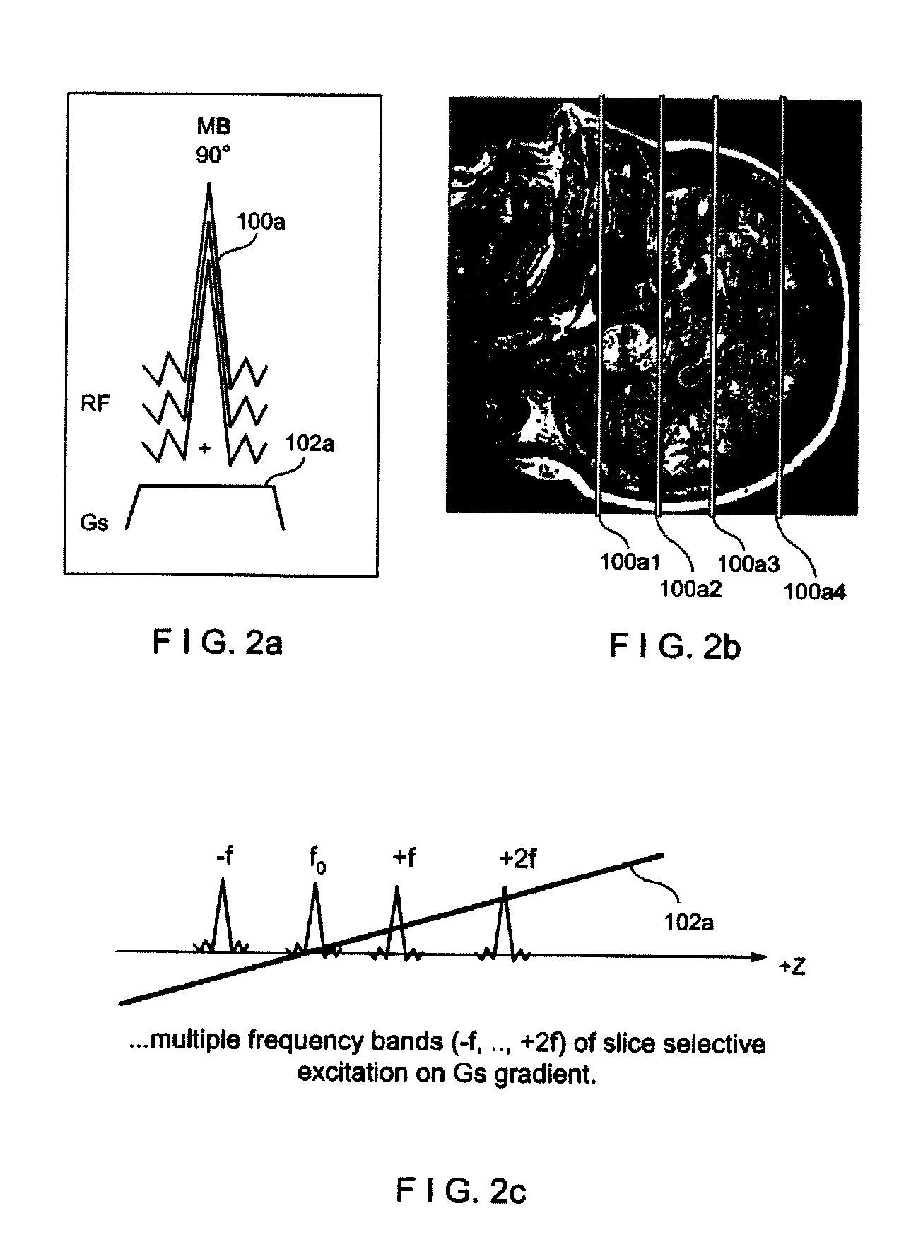 Multiplicative increase in MRI data acquisition with multi-band RF excitation pulses in a simultaneous image refocusing pulse sequence