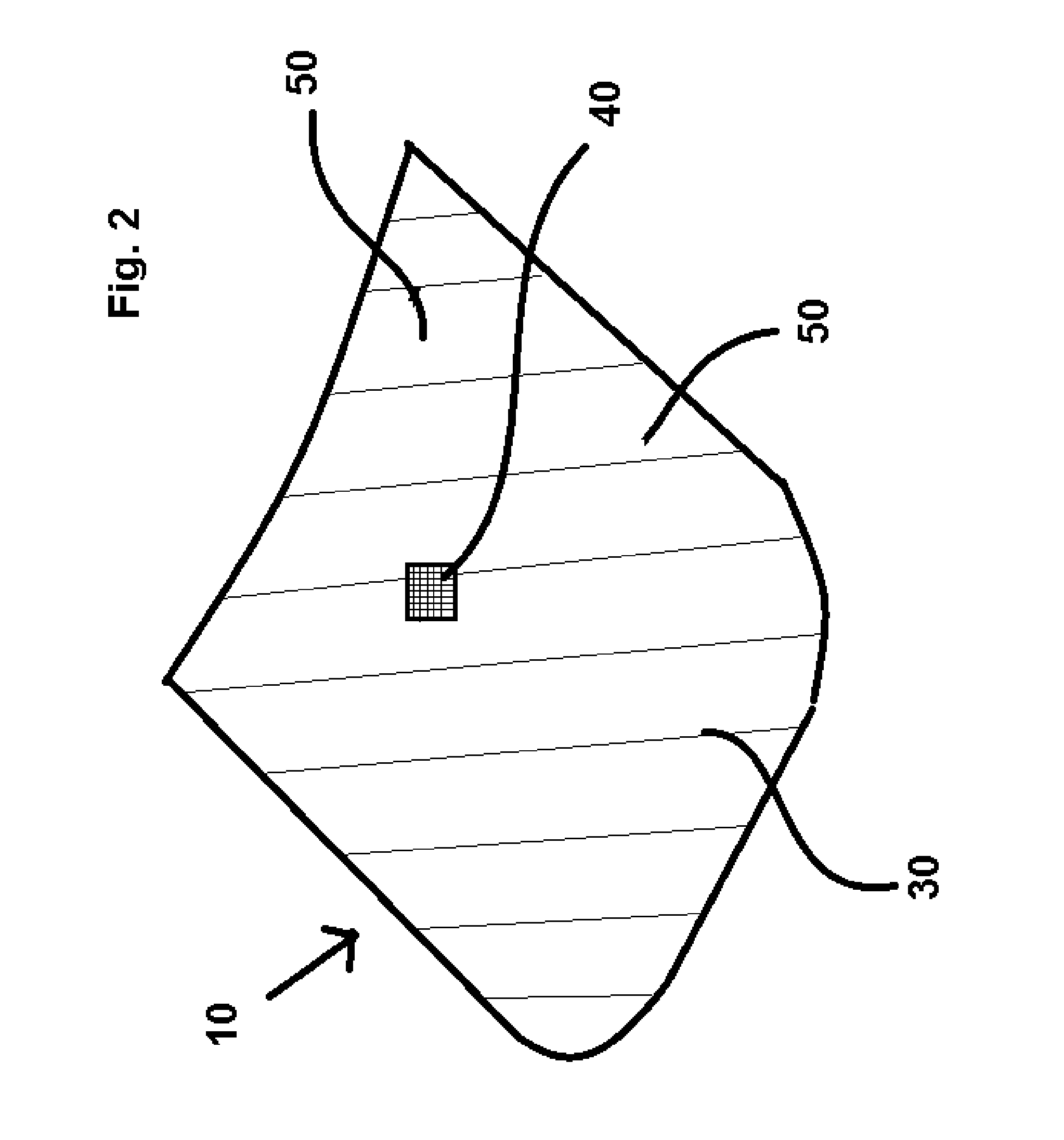 Sleep apnea prevention mask