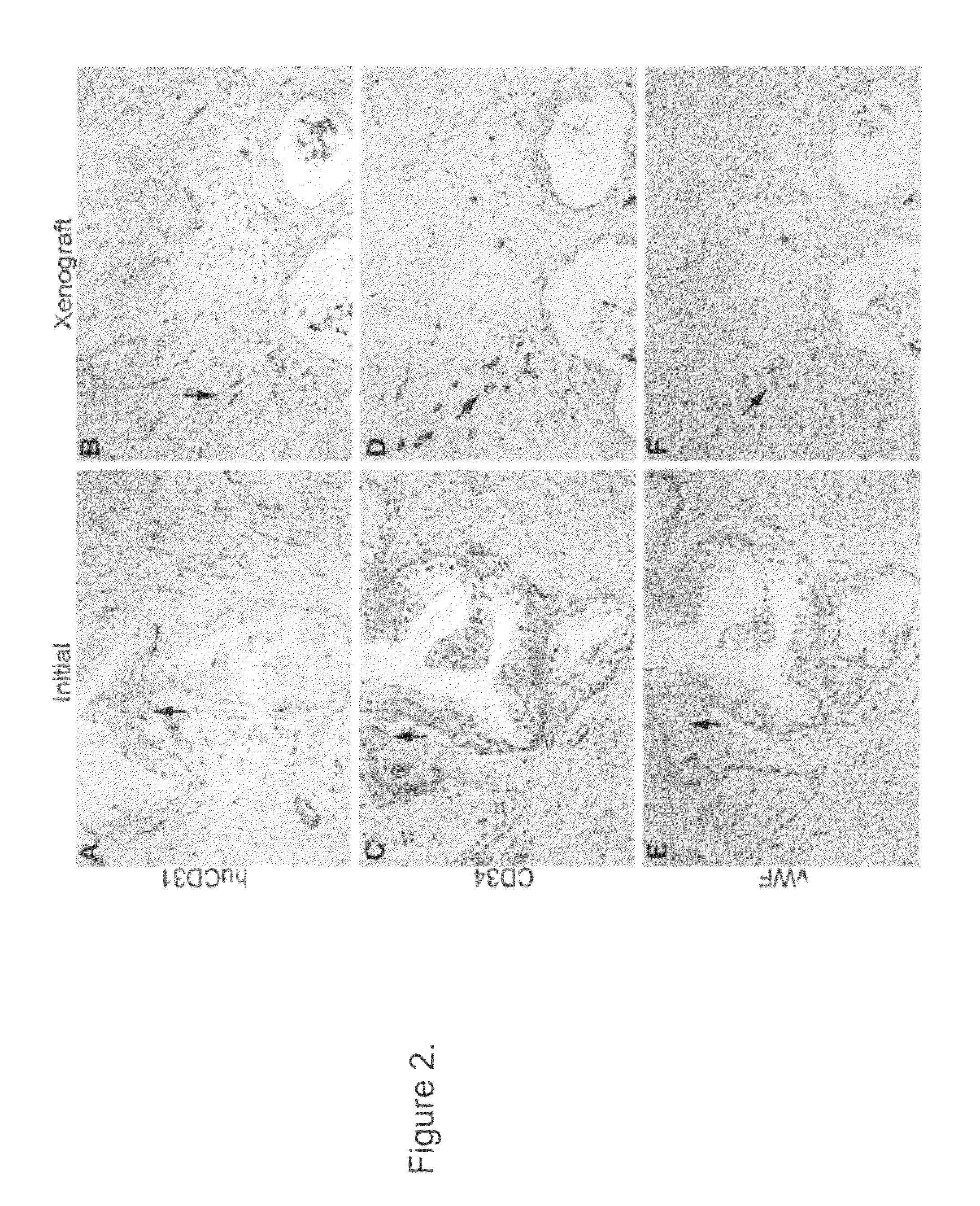 Methods for evaluating and implementing prostate disease treatments