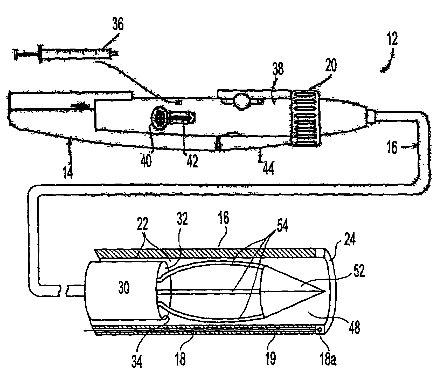 Apparatus and method for delivering therapeutic and diagnostic agents