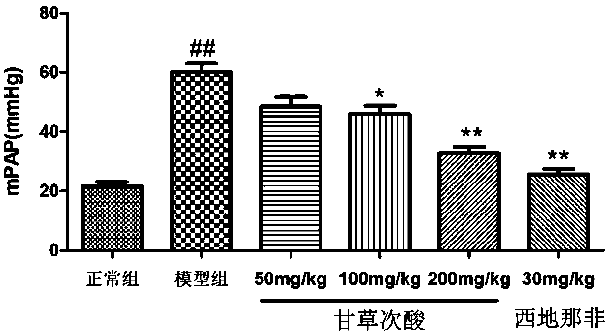 Application of glycyrrhetinic acid in preparing drug for treating pulmonary arterial hypertension