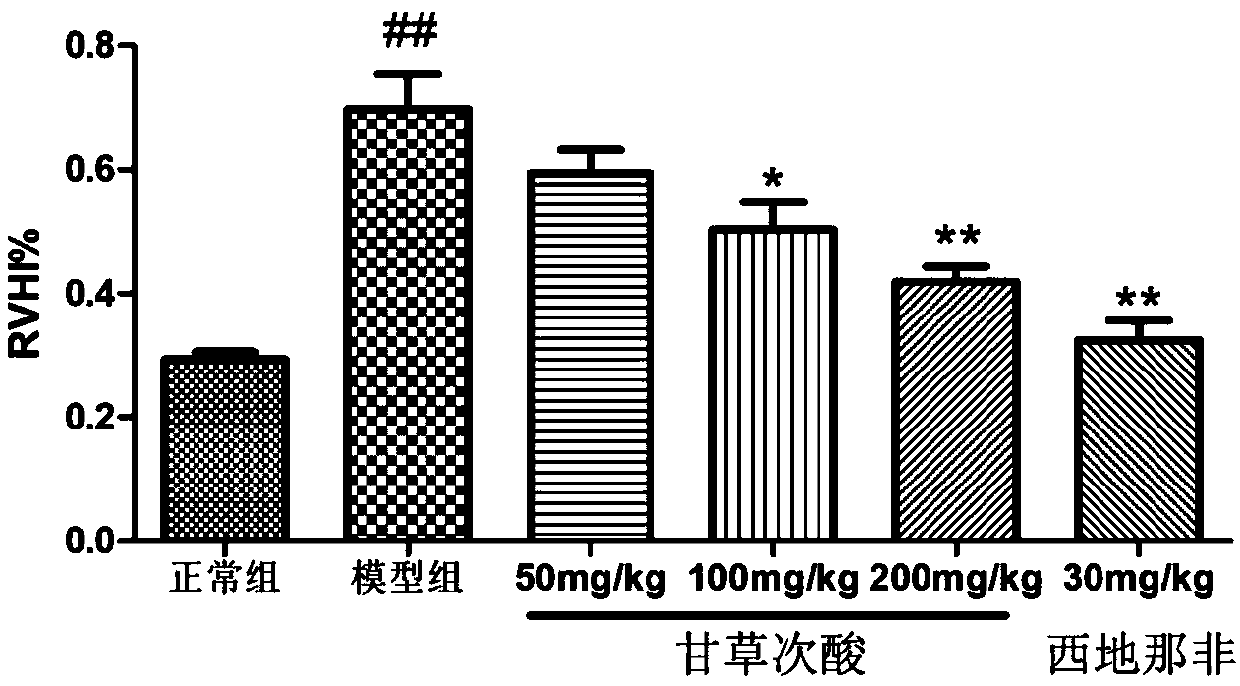 Application of glycyrrhetinic acid in preparing drug for treating pulmonary arterial hypertension