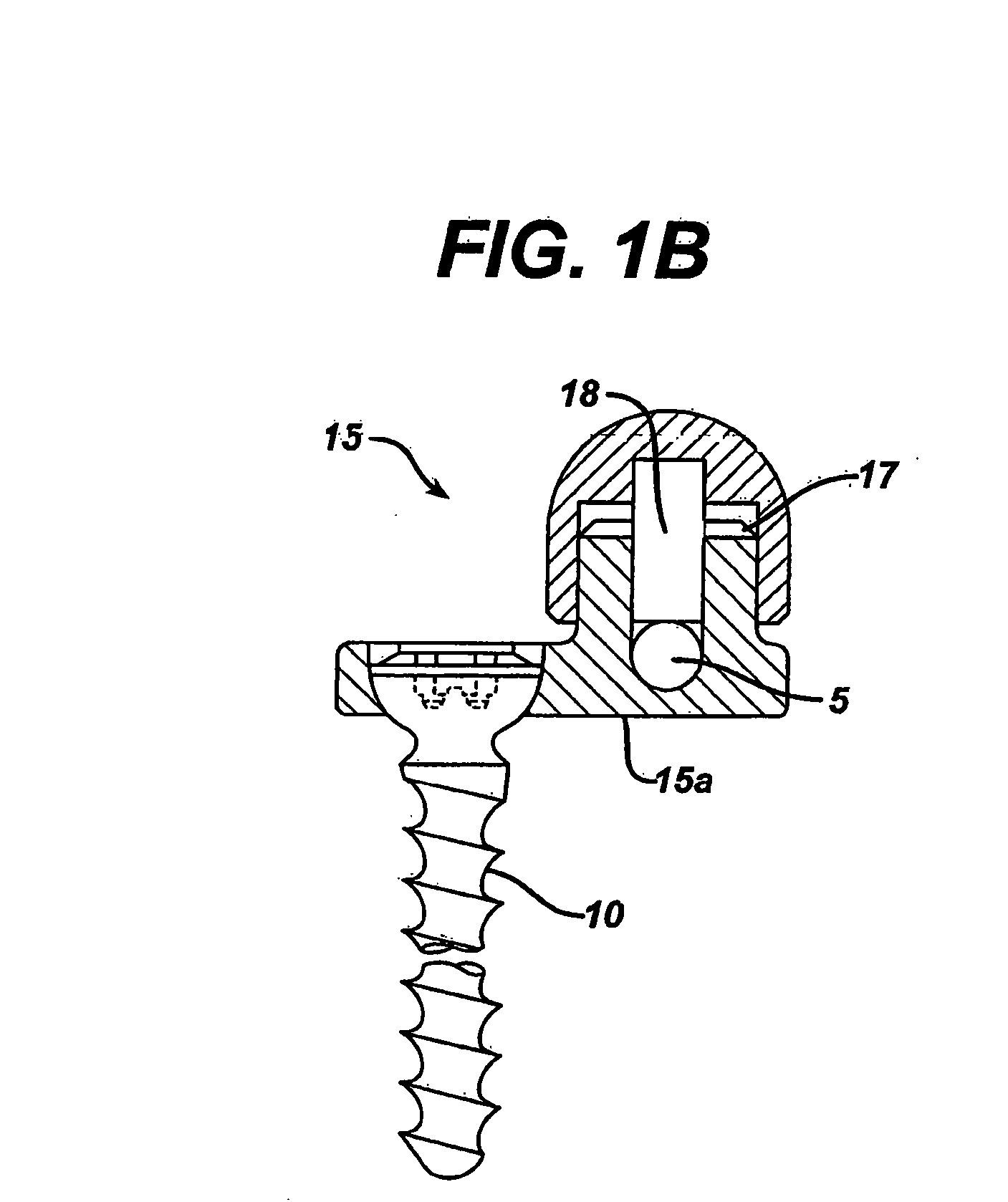 Locking cap assembly for spinal fixation instrumentation