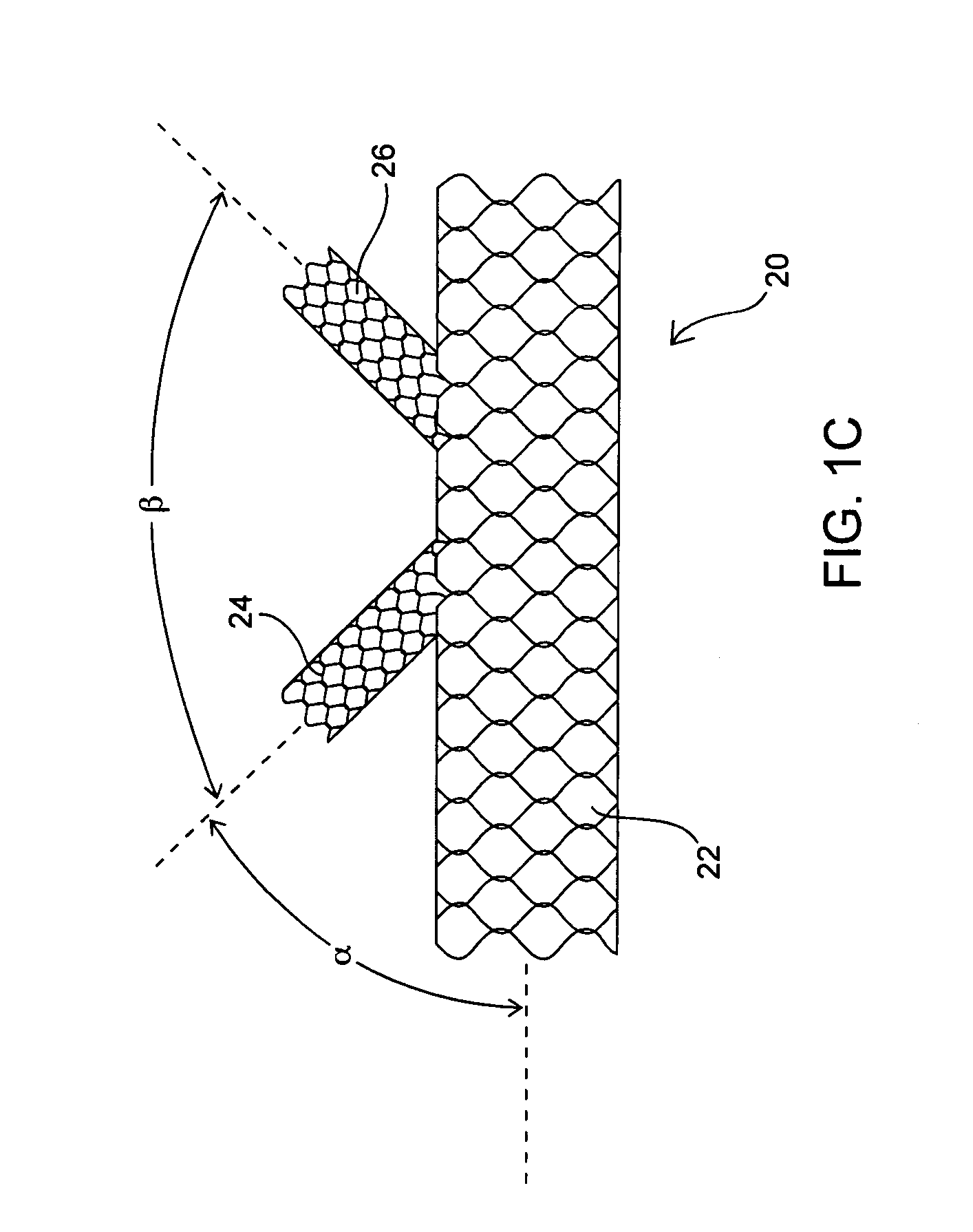 Methods for placing a stent in a branched vessel