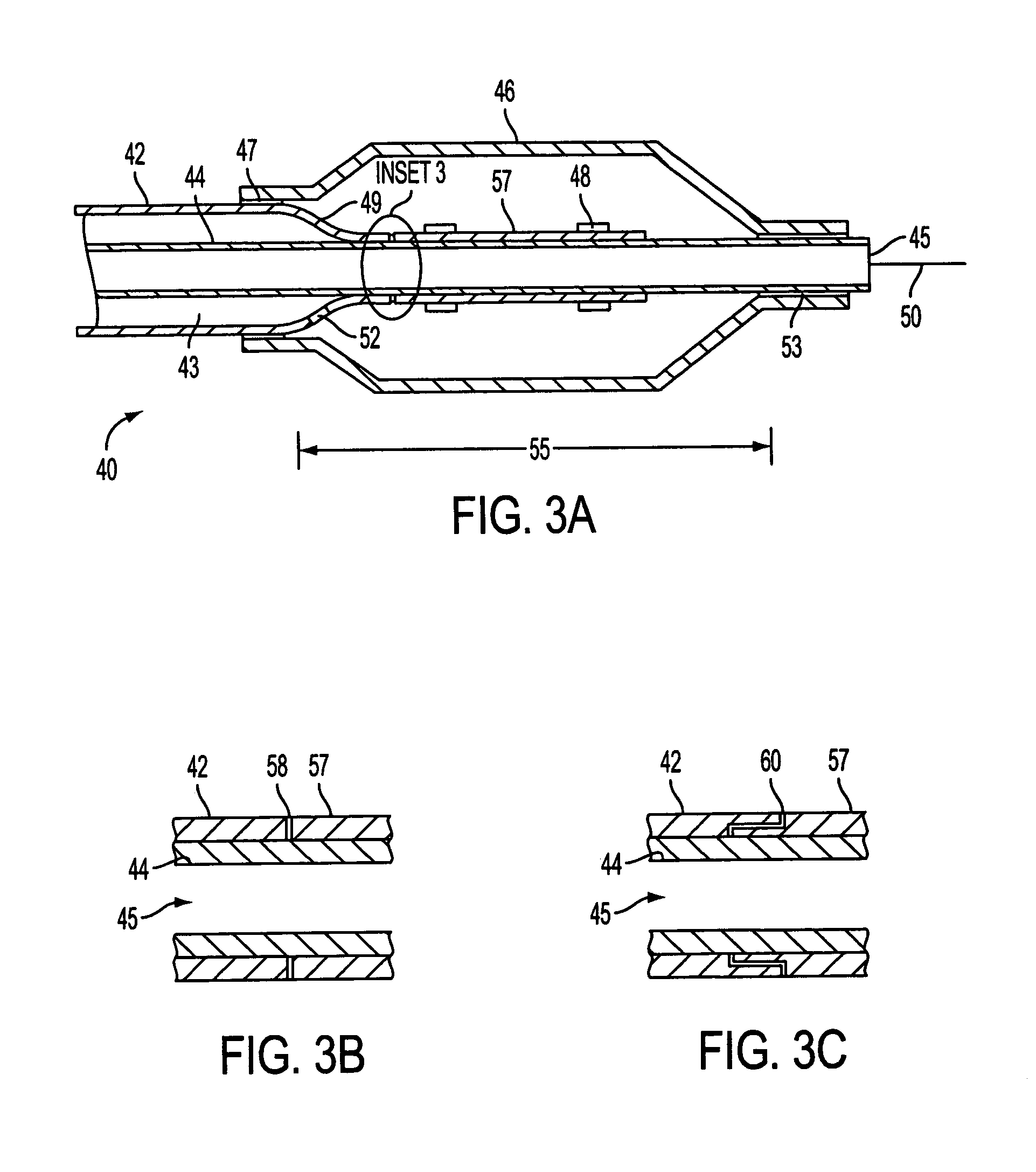 Catheter having enhanced distal pushability