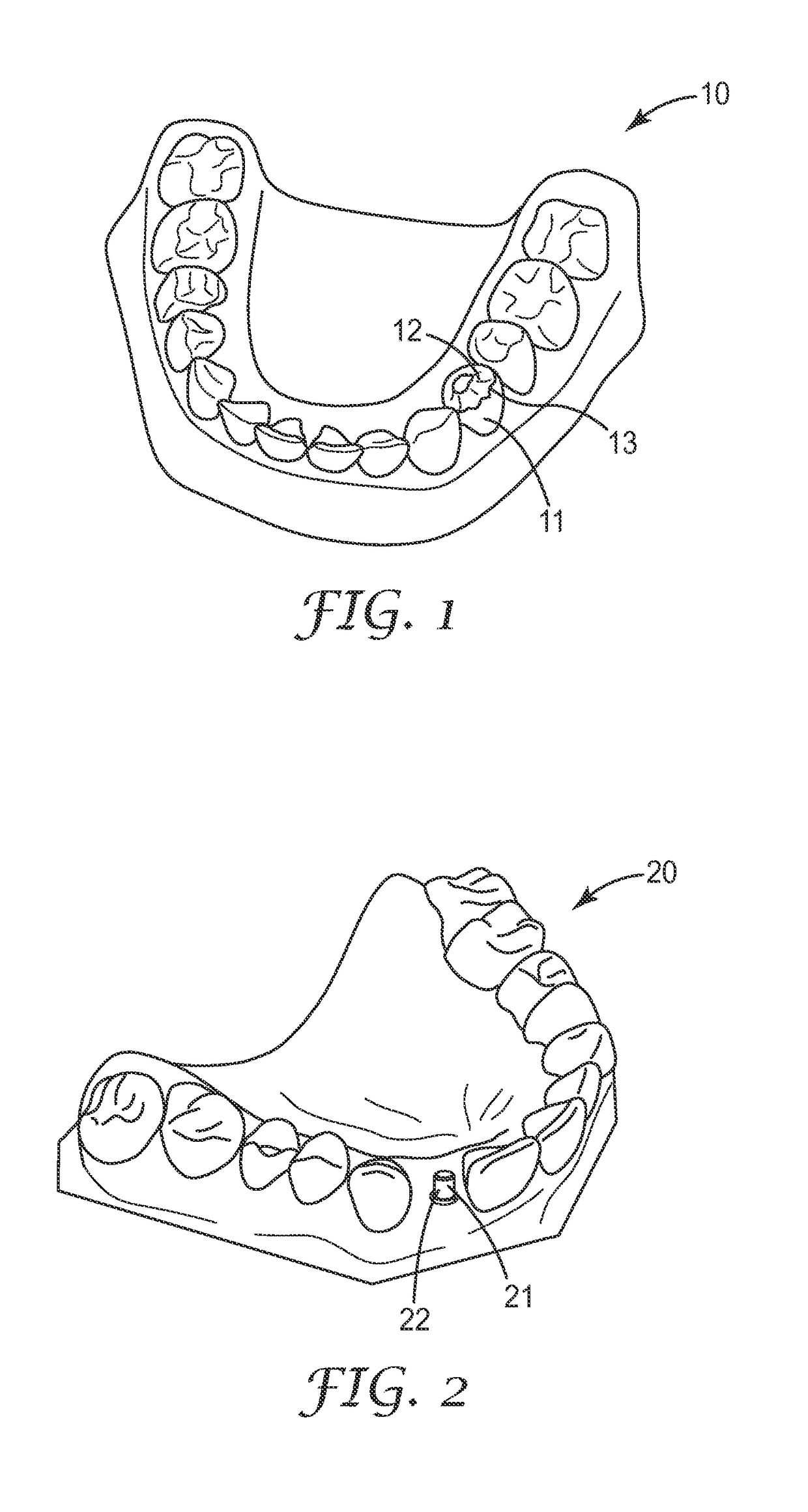 Method and system for making a dental restoration