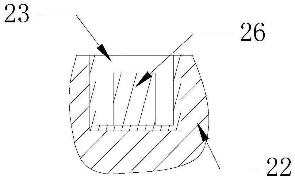 Gingival radian shaping device and preparation method thereof