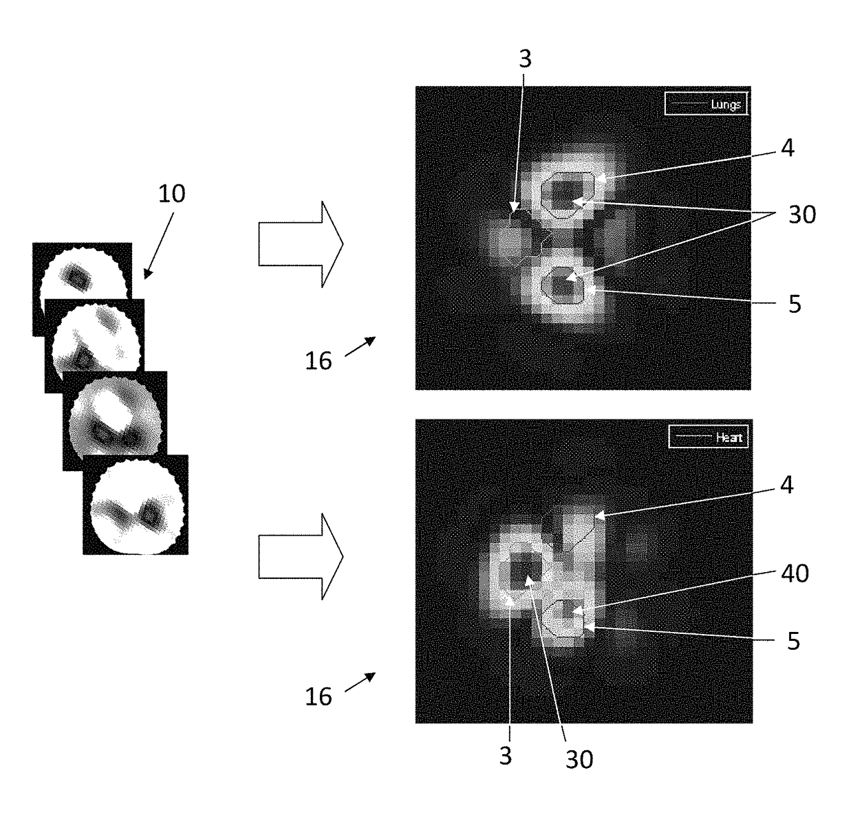 Method and apparatus for the non-invasive measurement of pulse transit times (PTT)