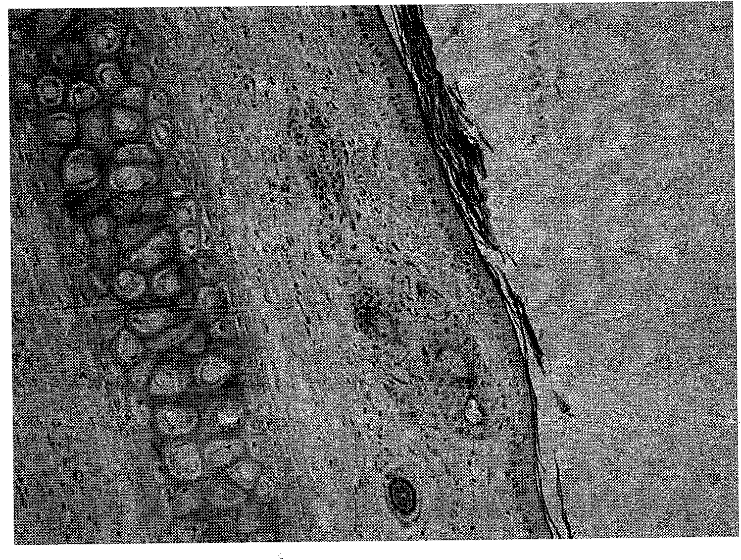 Nicotinylmethylamide freeze-dried powder preparation for injection and preparation method thereof