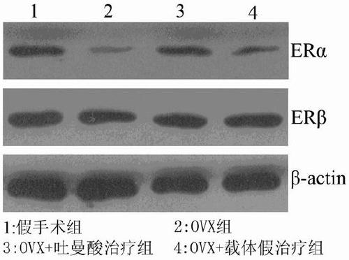 Application of tuccinic acid in the preparation of drugs for treating or preventing Alzheimer's disease caused by estrogen deficiency