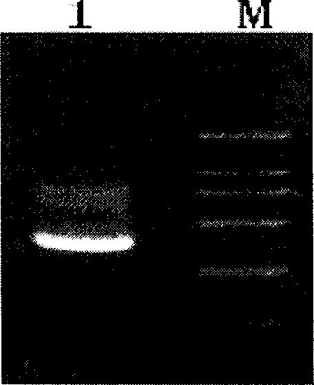 Staphylococcus aureus fusion protein of fibronectin and bindin, its preparation method and uses