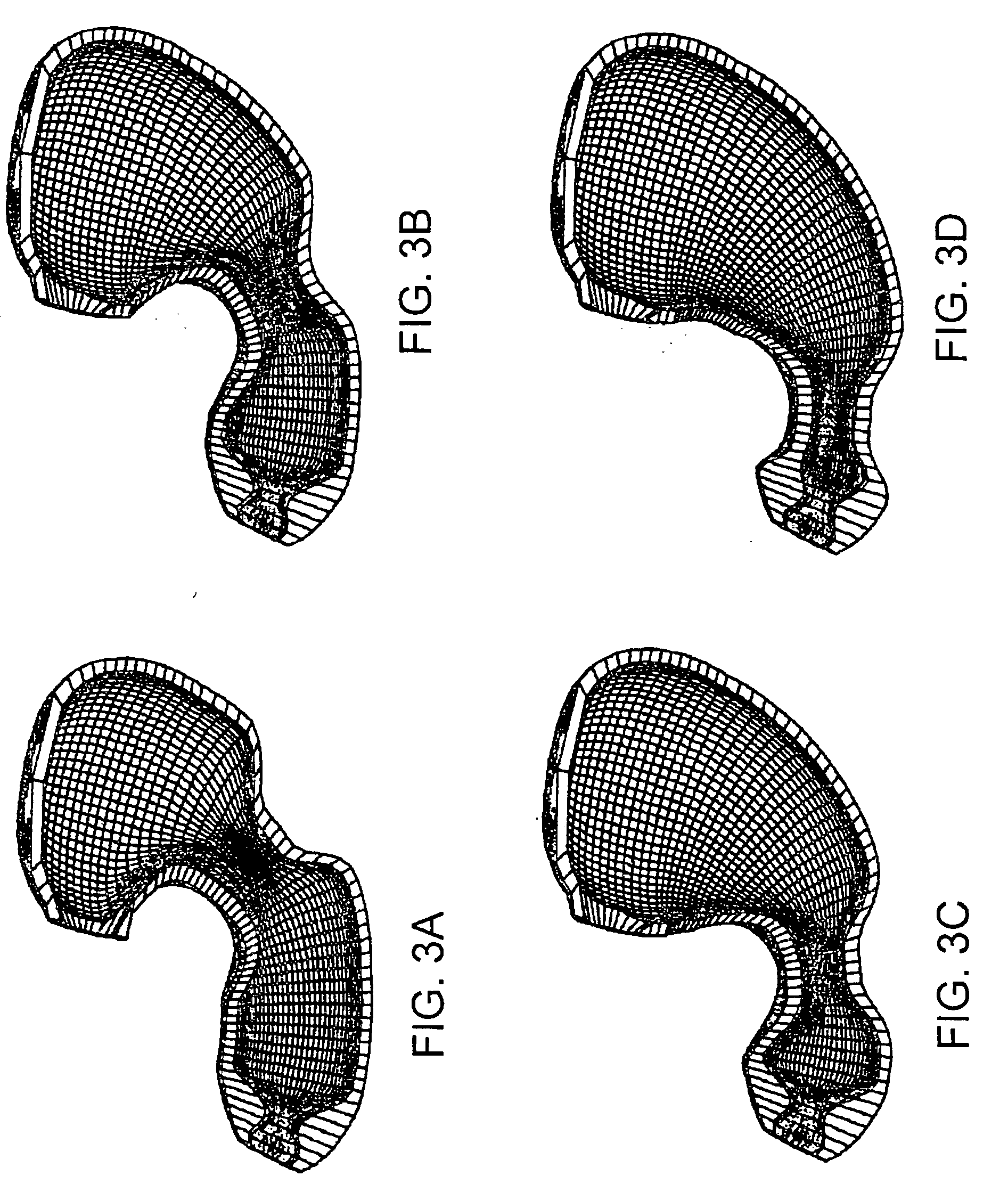 Gastrointestinal motility control