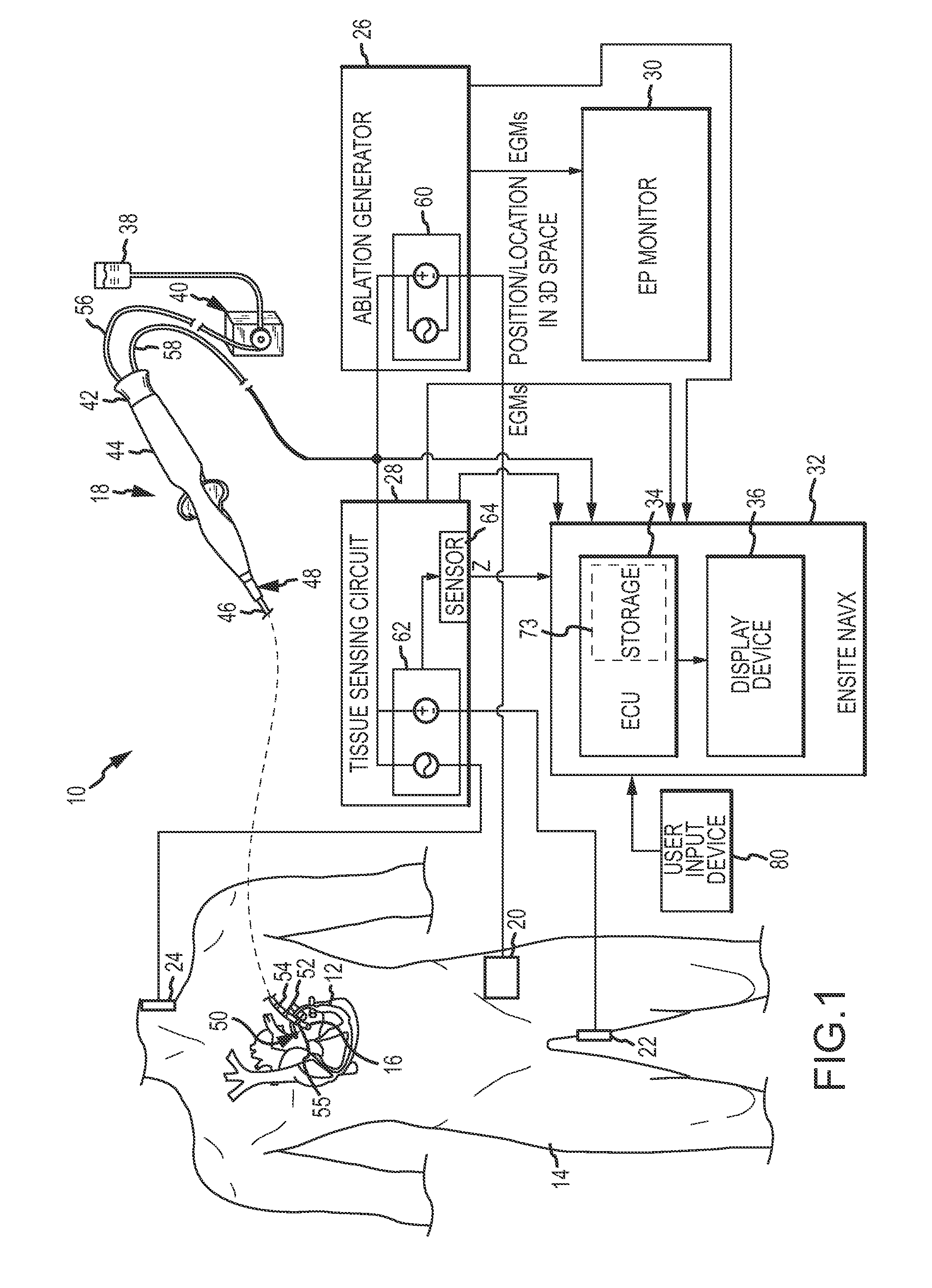 Graphical user interface for real-time RF lesion depth display