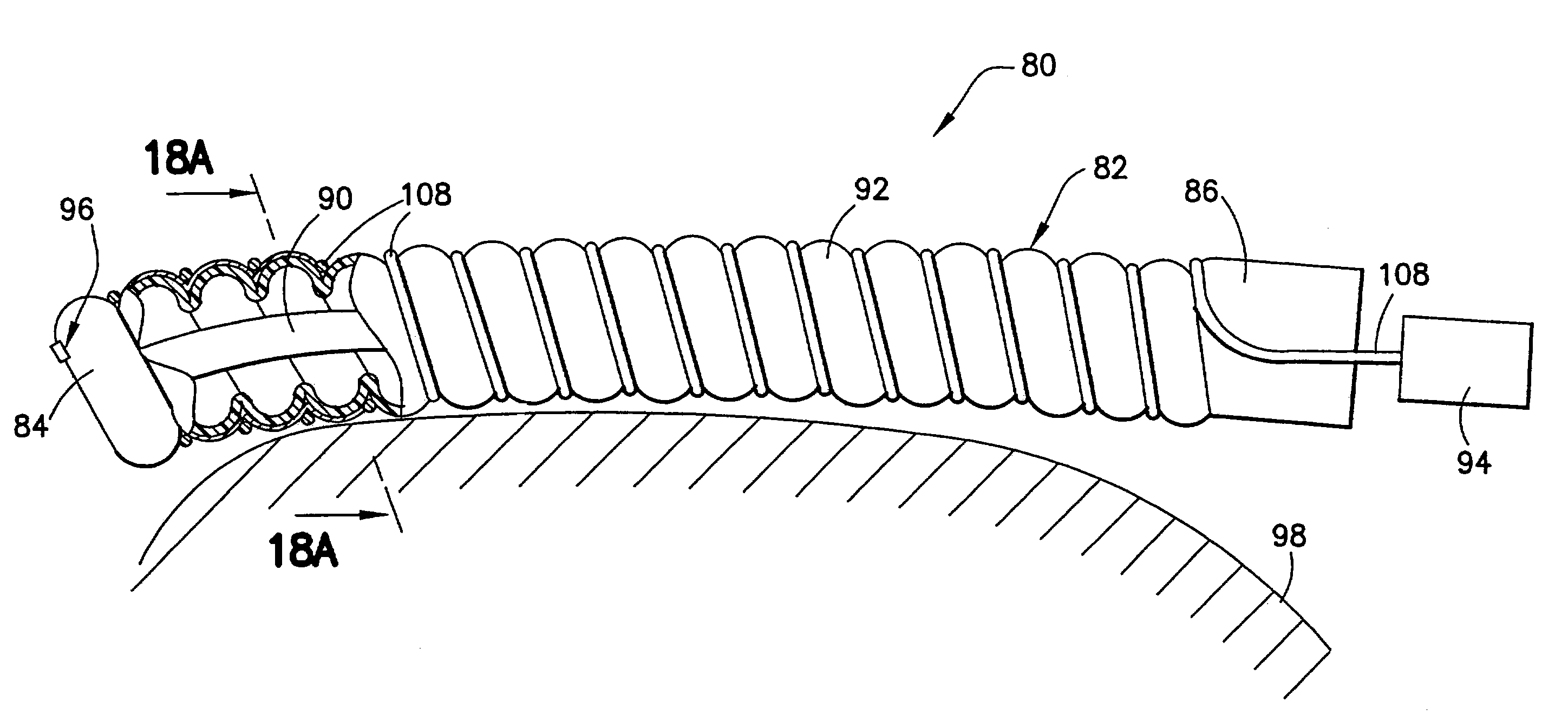 Kink resistant introducer with mapping capabilities