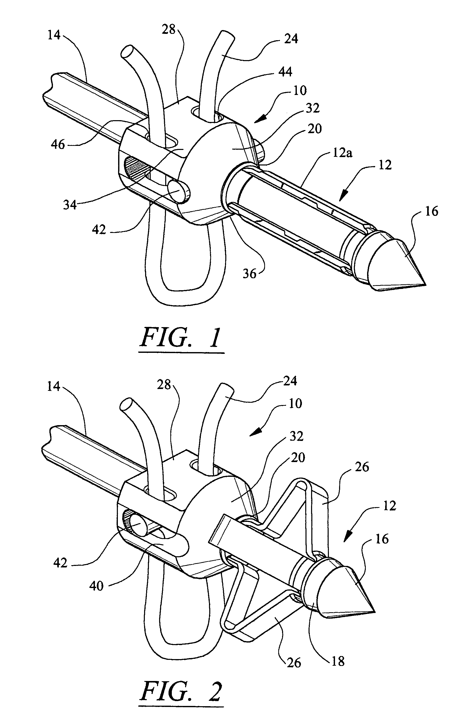 Anchor/suture used for medical procedures