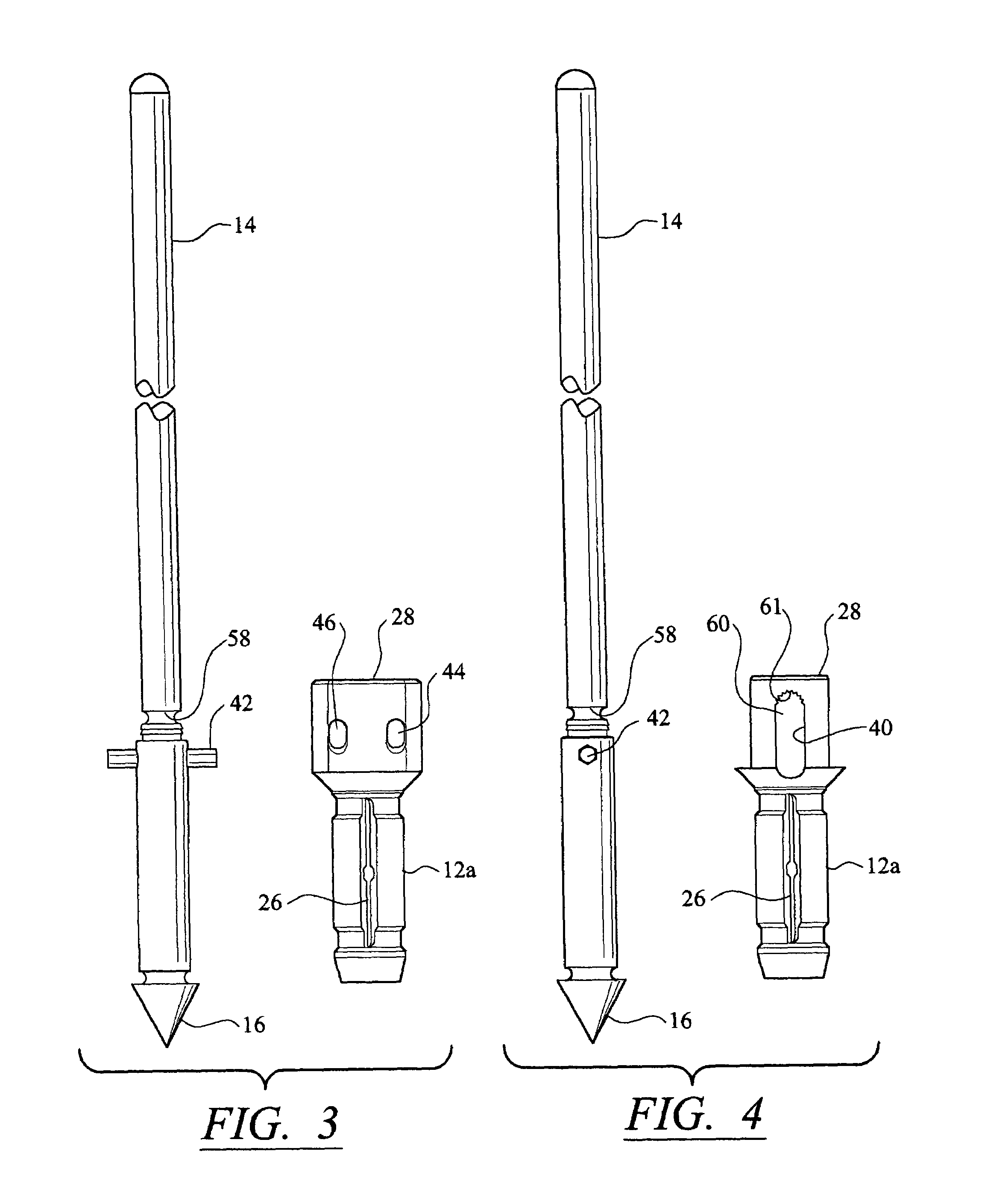 Anchor/suture used for medical procedures