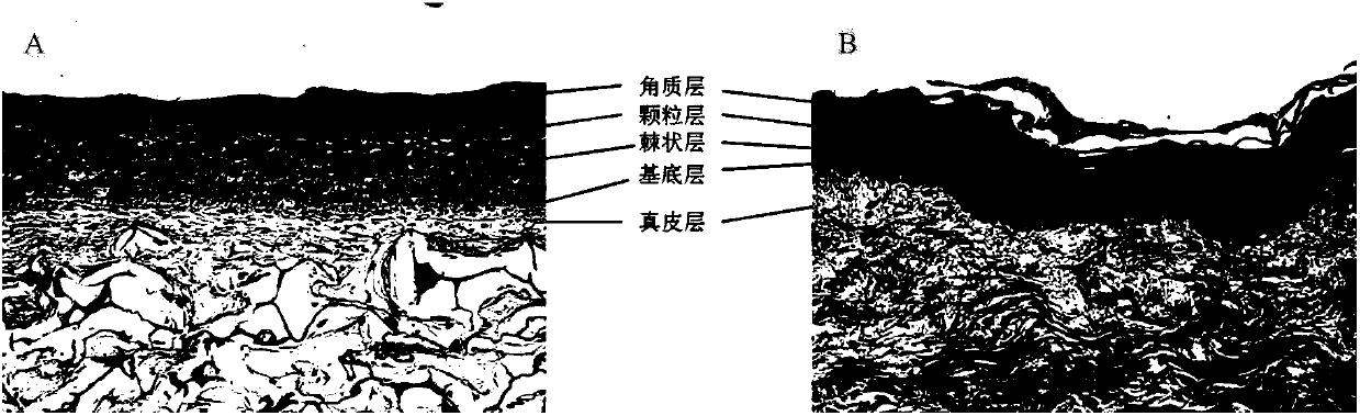 Application of deuterium depleted water as skin external use preparation and skin external use preparation containing deuterium depleted water