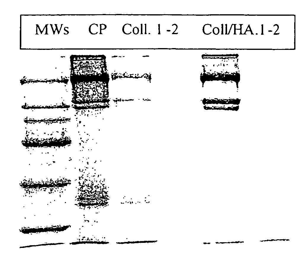 Pharmaceutical Compositions Containing Hyaluronic Acid and Collagenase for the Topical Treatment of Wounds, Burns and Ulcers