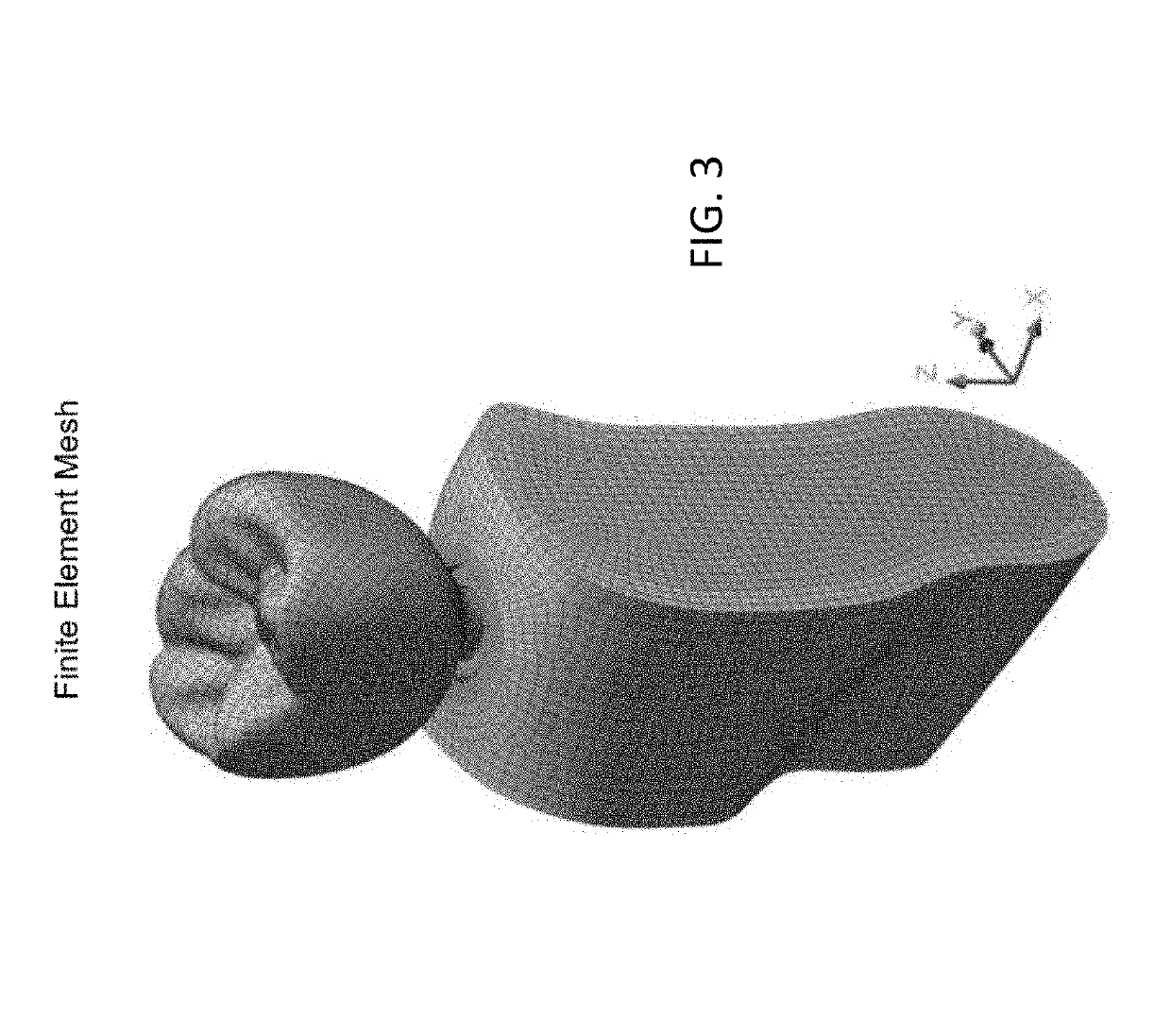 Implant made of fibre-reinforced plastic