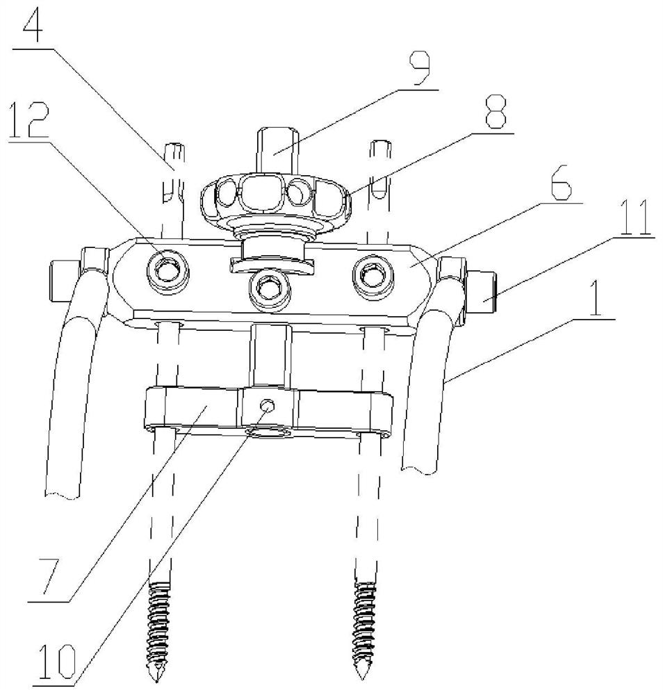 External fixing frame device for fibula transverse bone carrying and using method thereof