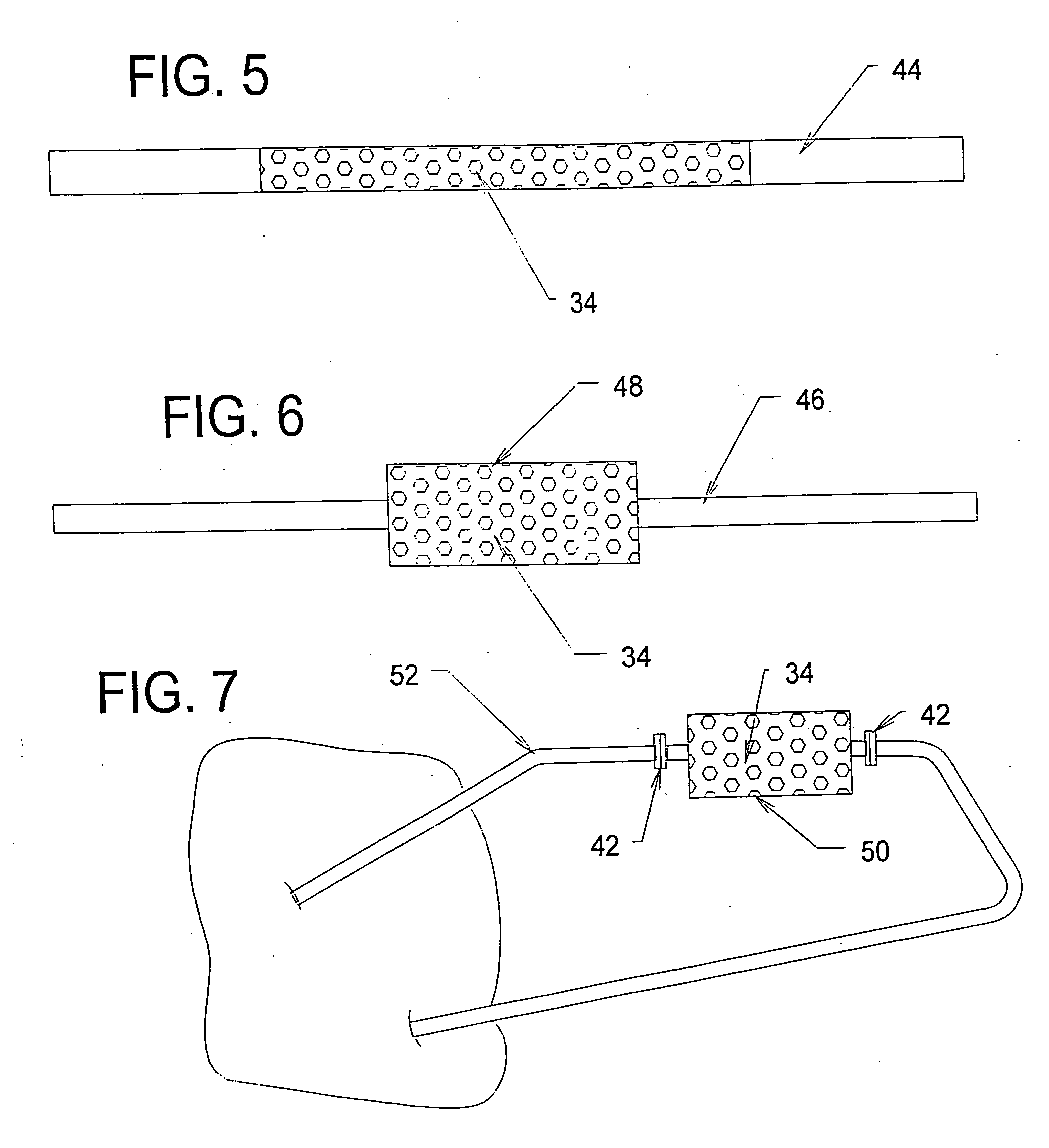 Biocompatible devices, systems, and methods for reducing levels of pro-inflammatory or anti-inflammatory stimulators or mediators in the blood