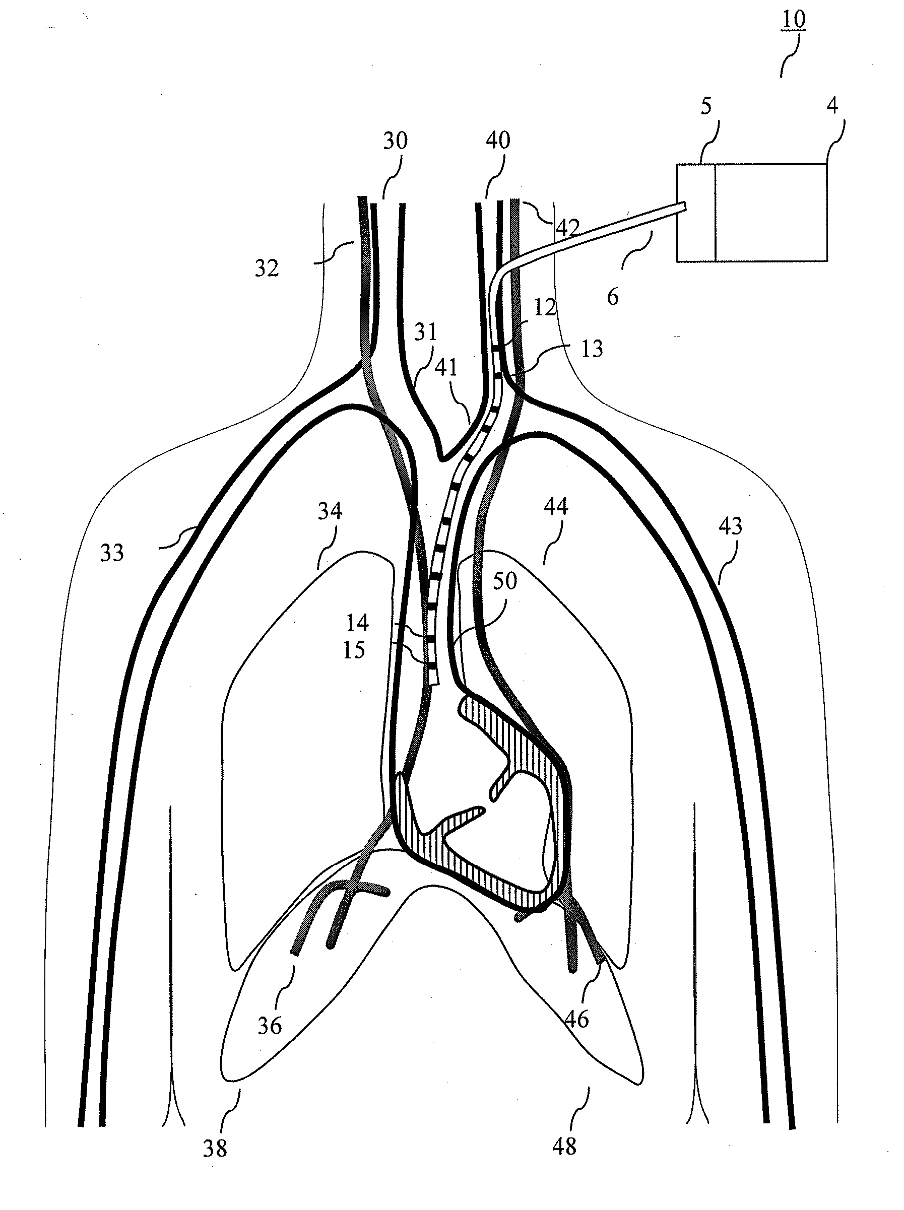 Method and device for respiratory and cardiorespiratory support