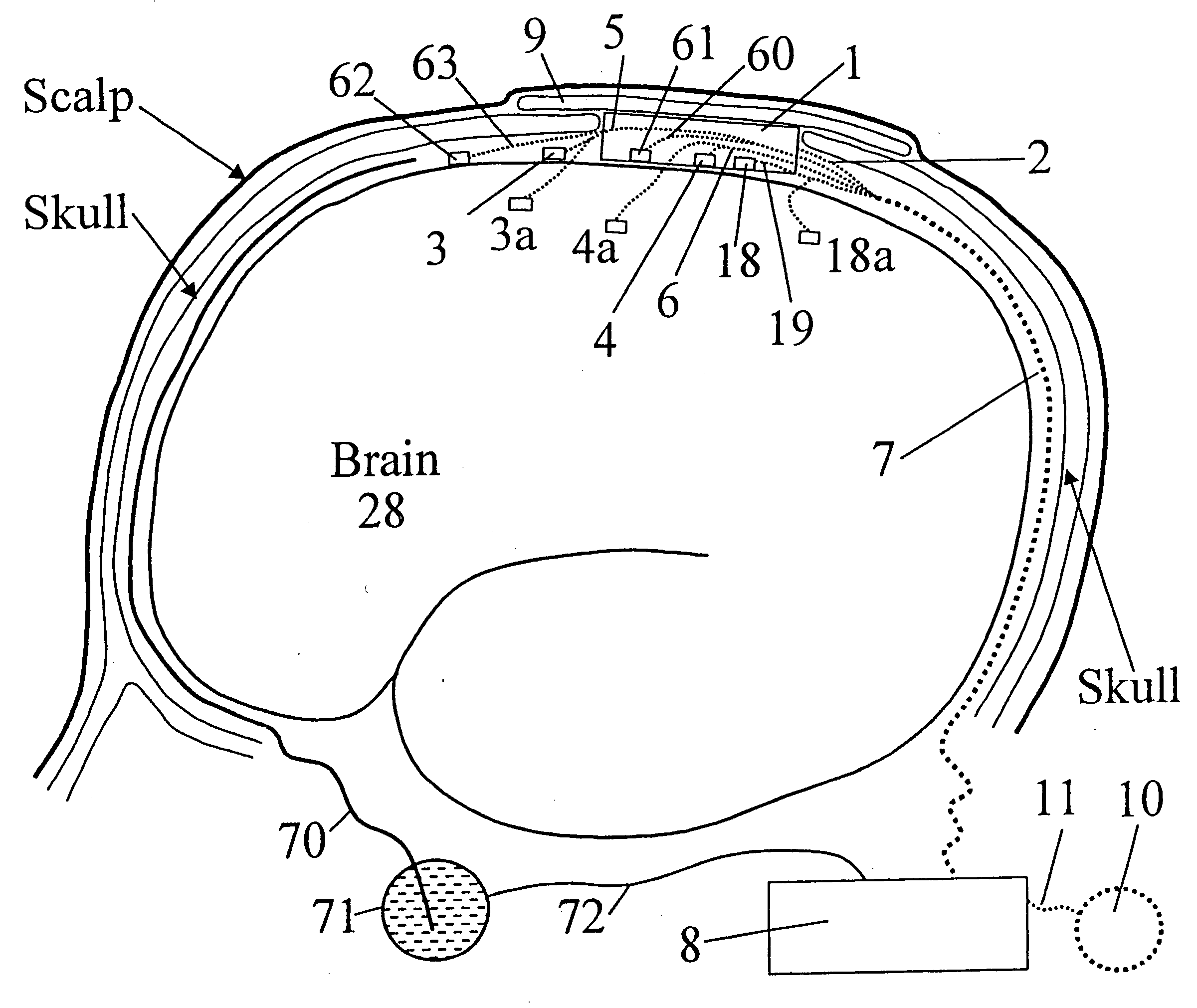 Techniques using heat flow management, stimulation, and signal analysis to treat medical disorders