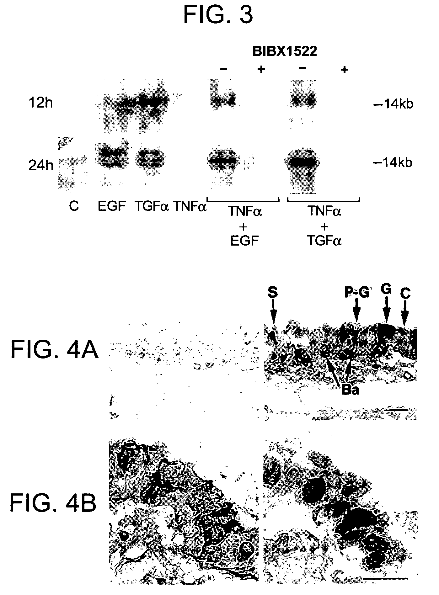 Preventing airway mucus production by administration of EGF-R antagonists