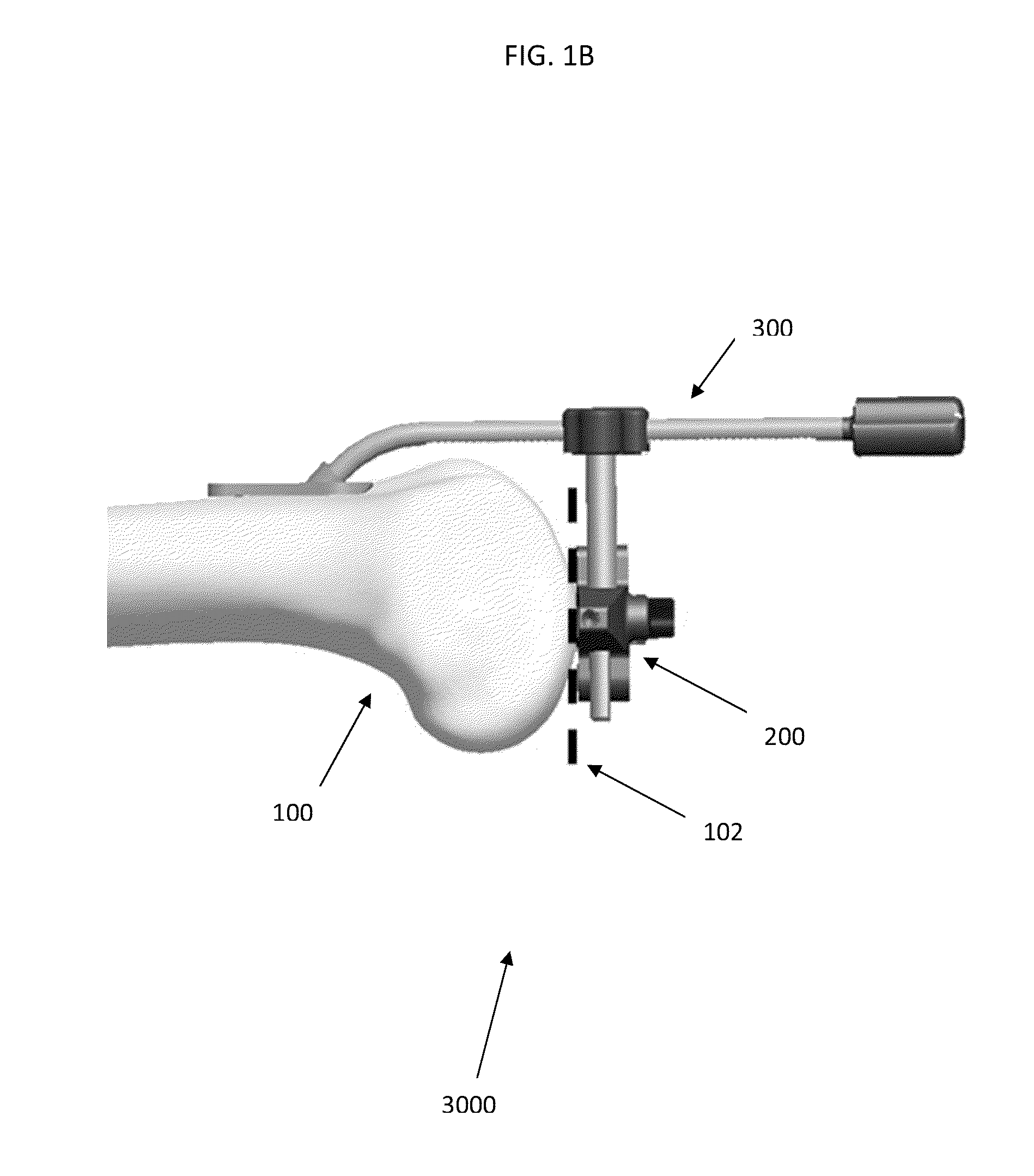 Anatomically guided instrumentation for trochlear groove replacement