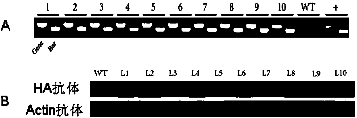 Maize calcineurin B albuminoid ZmCBL10 gene and applications thereof