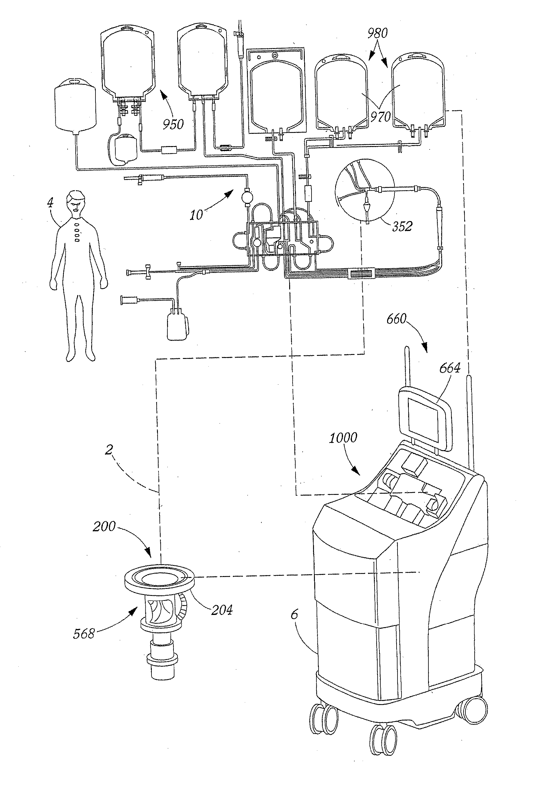 Method and Apparatus for Leukoreduction of Red Blood Cells