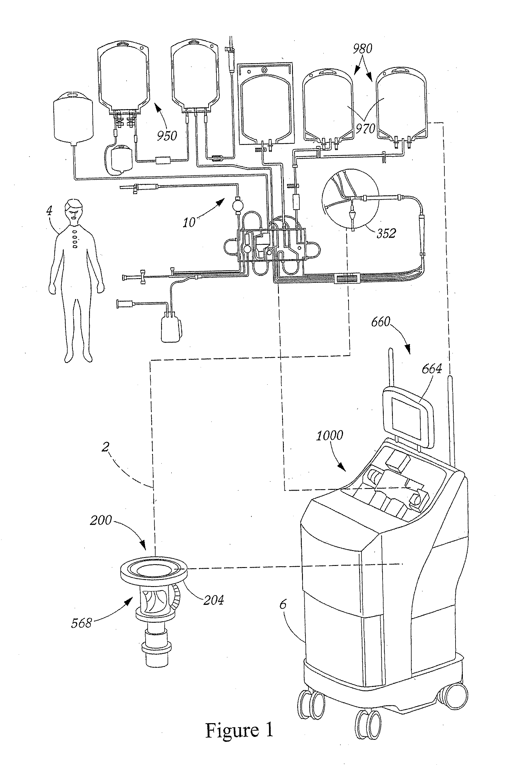 Method and Apparatus for Leukoreduction of Red Blood Cells