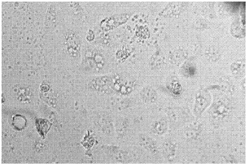 Method for synthesizing anticancer compound Na4Bi2Mn2W20C6H84N4O105