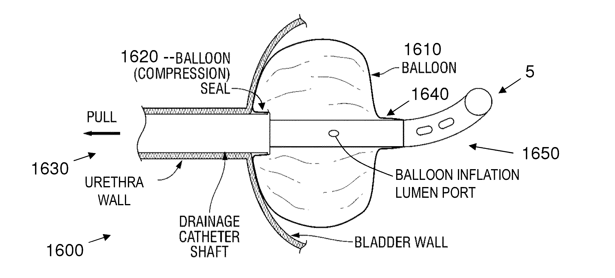 Stretch Valve Balloon Catheter and Methods for Producing and Using Same