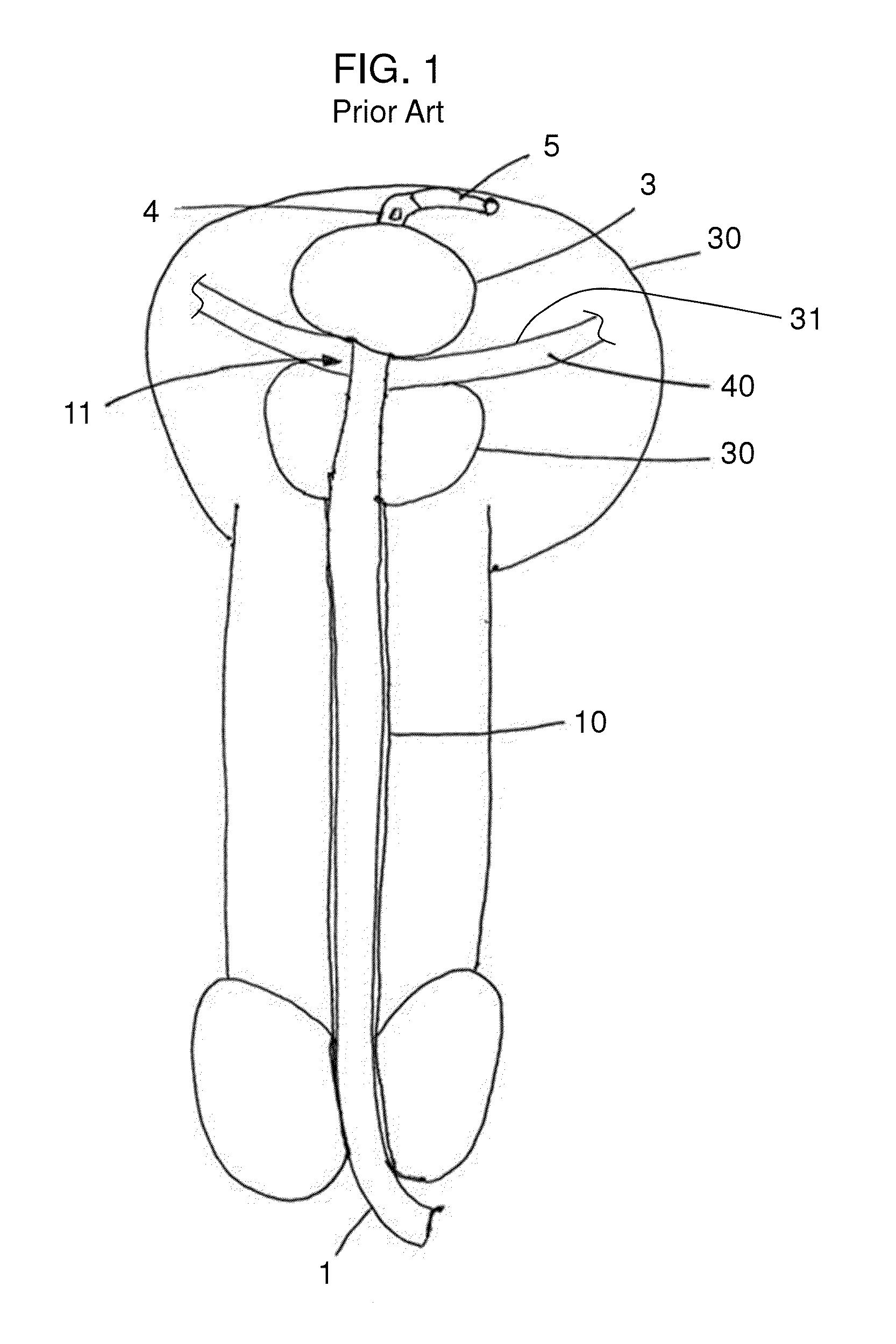 Stretch Valve Balloon Catheter and Methods for Producing and Using Same