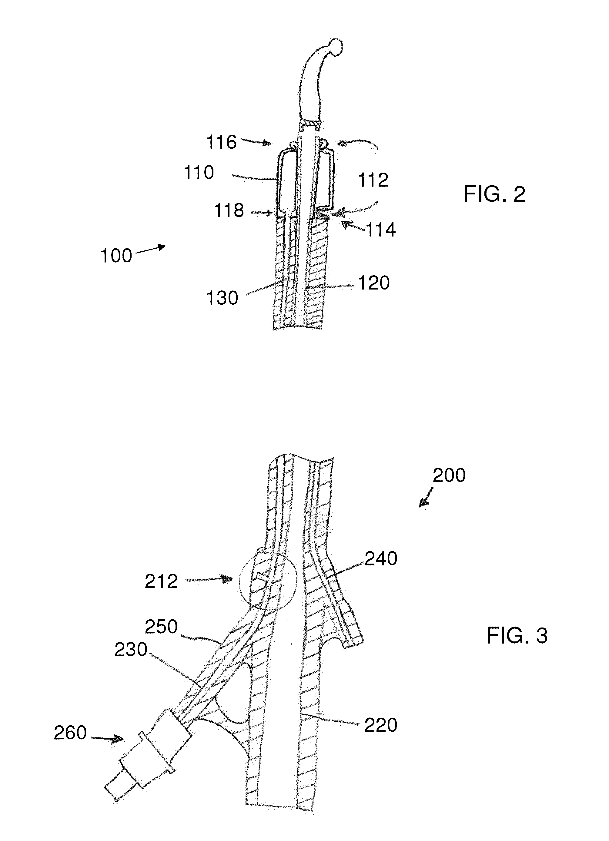 Stretch Valve Balloon Catheter and Methods for Producing and Using Same