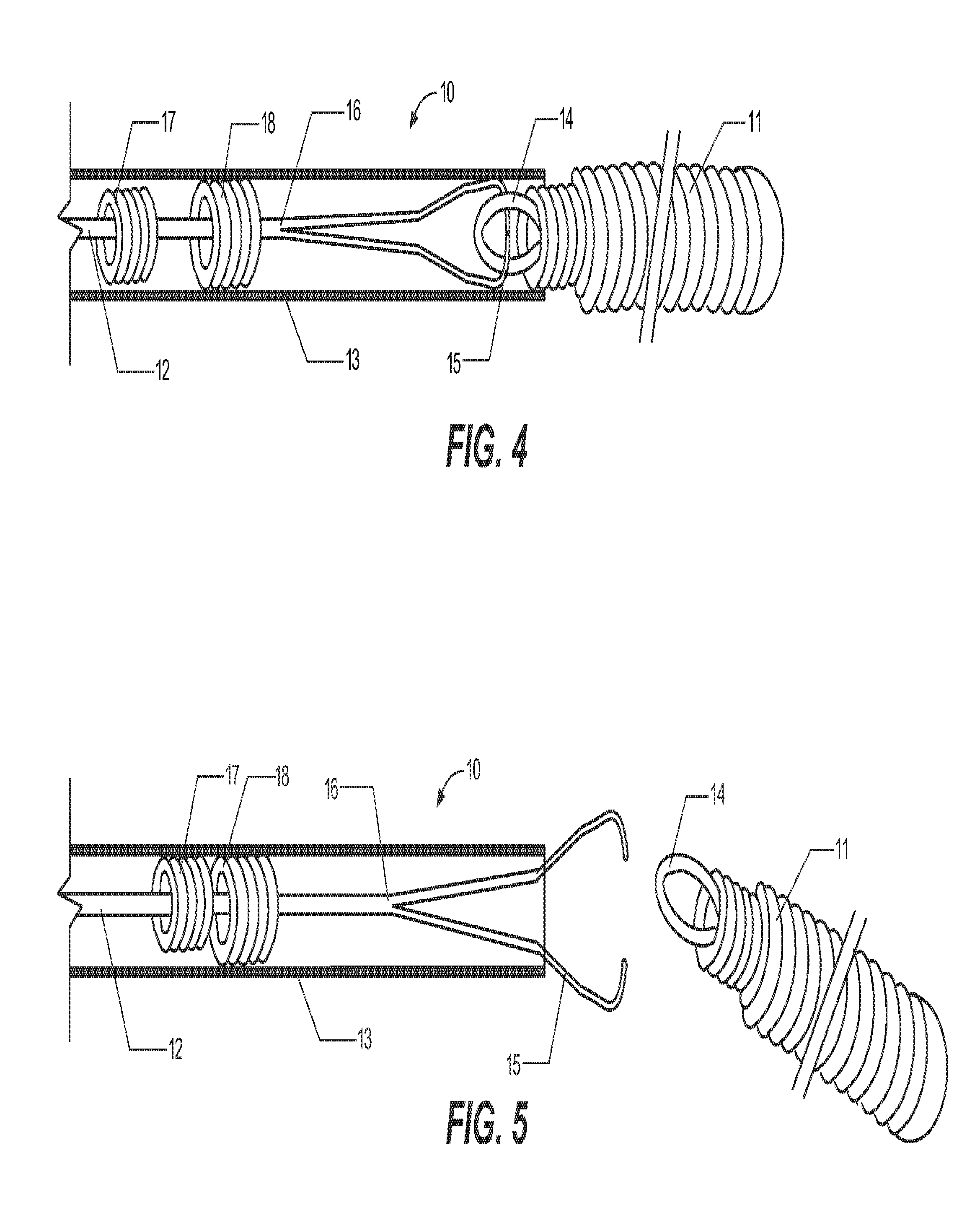 Delivery assembly for occlusion device using mechanical interlocking coupling mechanism