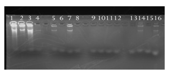 Pre-amplification method for trace DNA applied in medicolegal expertise