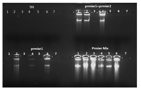 Pre-amplification method for trace DNA applied in medicolegal expertise