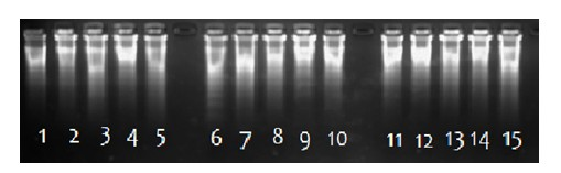 Pre-amplification method for trace DNA applied in medicolegal expertise