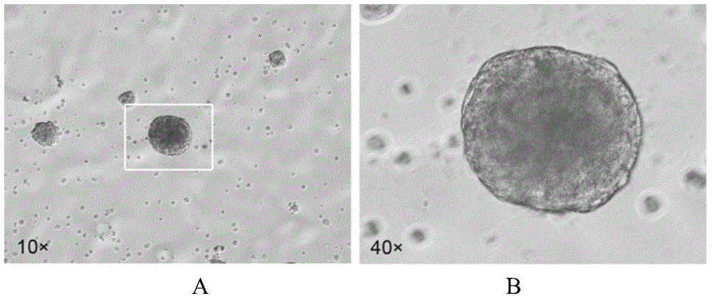 Method for inducing Muse cells in adult bone marrow into neural precursor cells (NPCs)