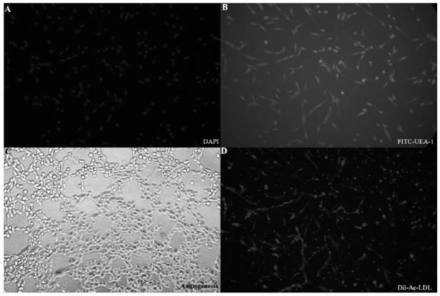 Brain microvascular endothelial cell extraction and purification method