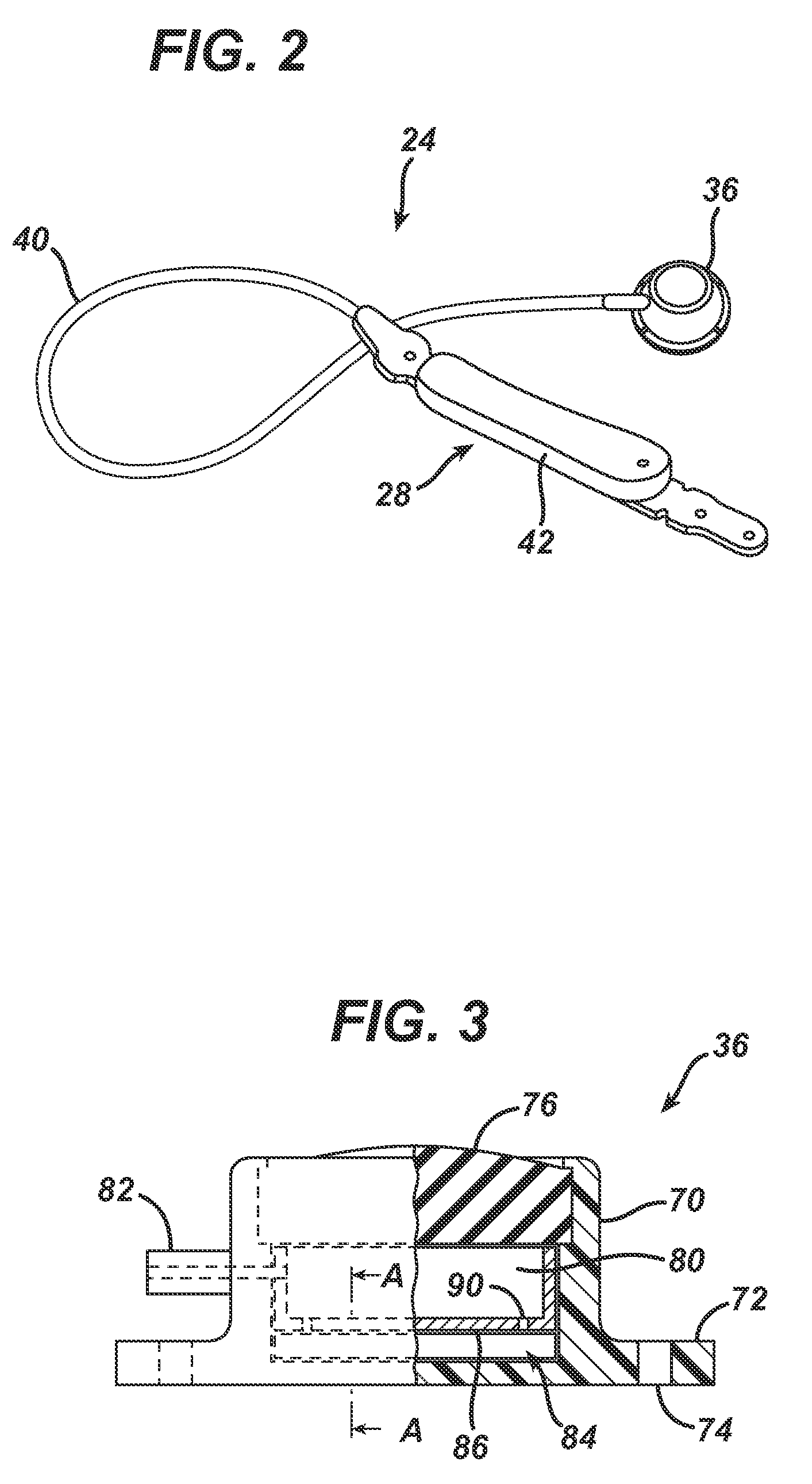 Physiological Parameter Analysis for an Implantable Restriction Device and a Data Logger