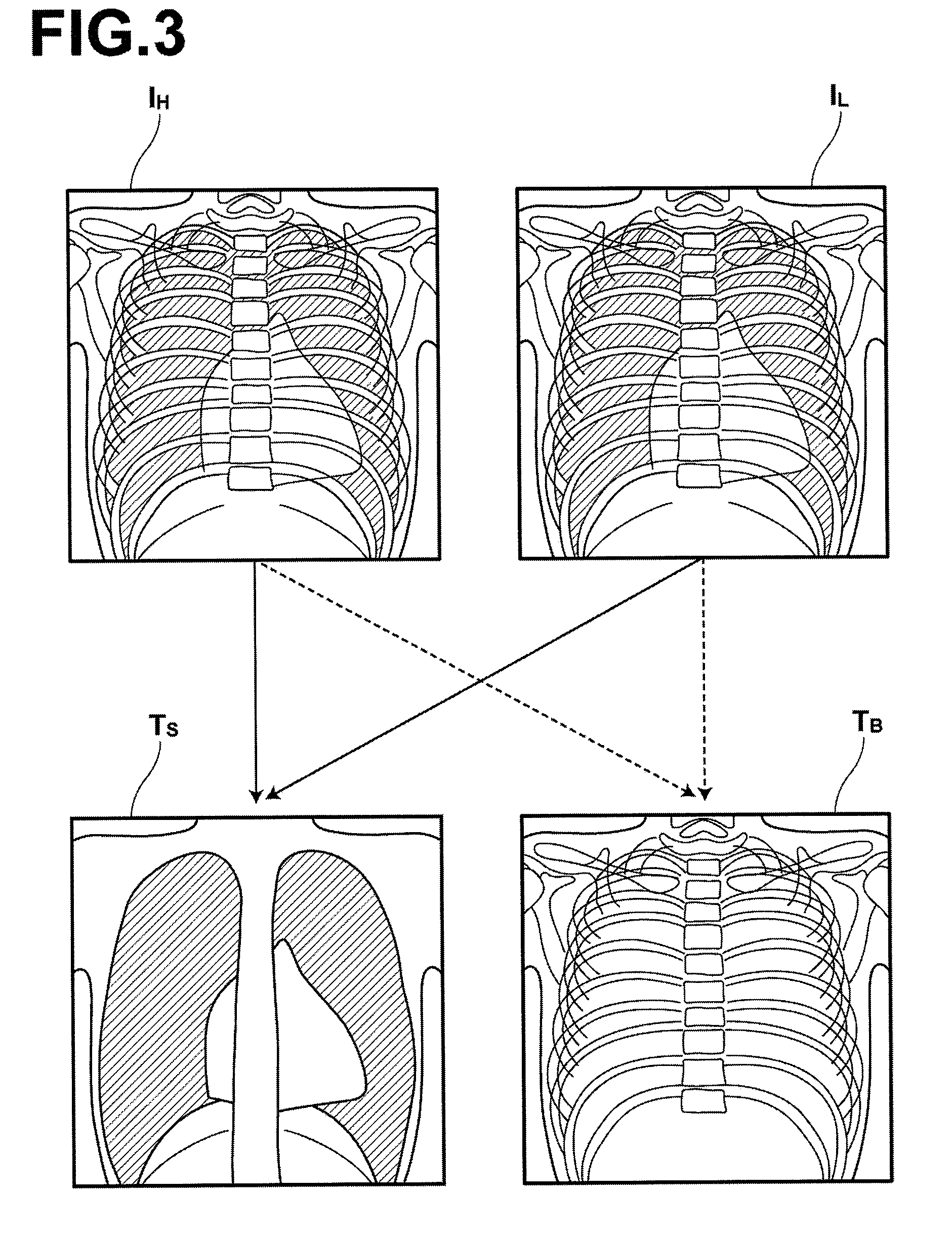 Alignment apparatus and program therefor