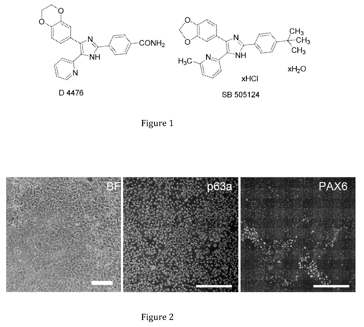 Differentiation of pluripotent stem cells into corneal cells