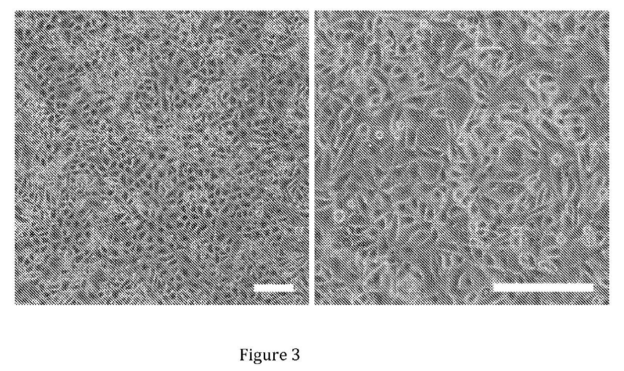 Differentiation of pluripotent stem cells into corneal cells