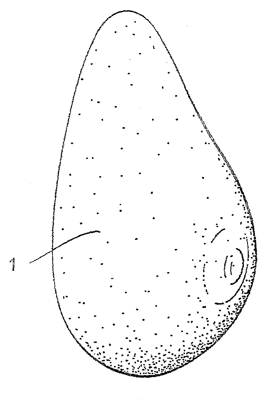 Light-Weight External Breast Prosthesis